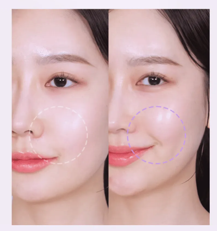 BIOHEAL BOH - Probioderm Melting Collagen Deep Shot - Set speciale per naso-labbra e guance