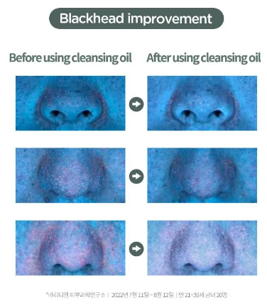 Anua - Heartleaf Pore Control Cleansing Oil - Olio Detergente