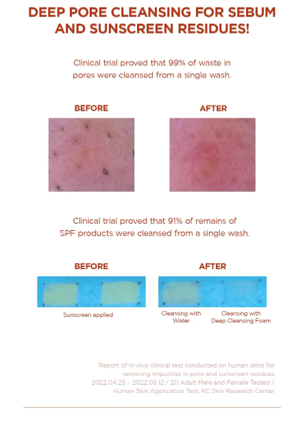 SKIN 1004 - Madagascar Centella Poremizing Deep Cleansing Foam
