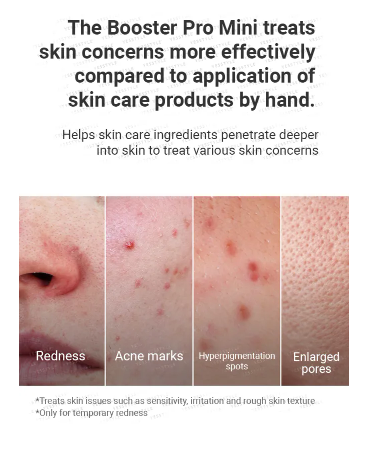 medicube - AGE-R Booster Pro Mini Pink - Dispositivo Skincare Multifunzione Rosa