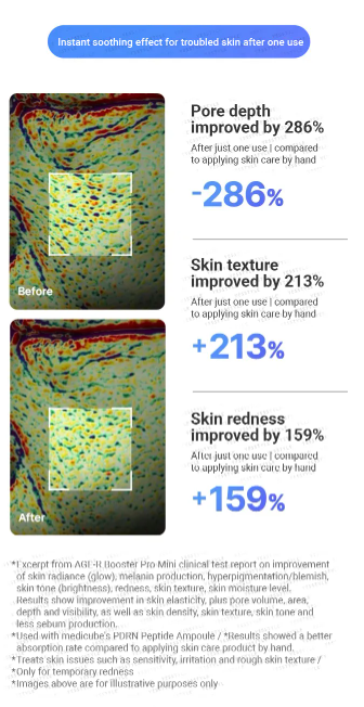 medicube - AGE-R Booster Pro Mini Pink - Dispositivo Skincare Multifunzione Rosa