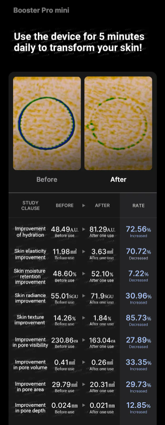 medicube - AGE-R Booster Pro Mini Pink - Dispositivo Skincare Multifunzione Rosa